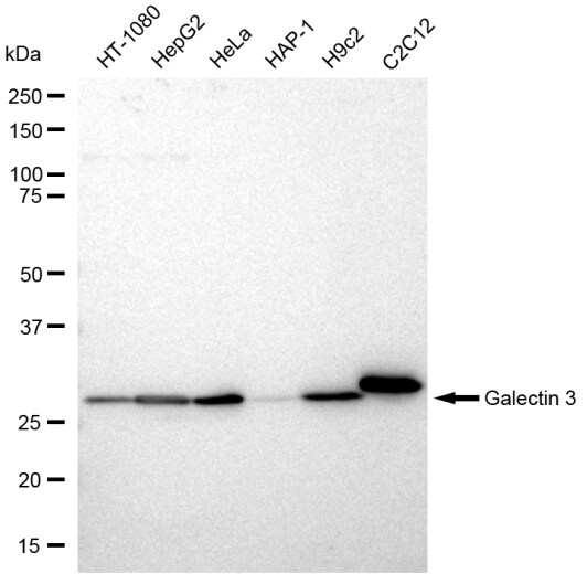 Galectin-3 Antibody (23GB2130)