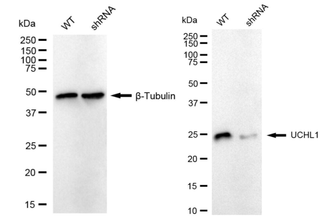 UCH-L1/PGP9.5 Antibody (23GB2135)