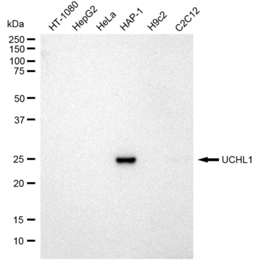 UCH-L1/PGP9.5 Antibody (23GB2135)
