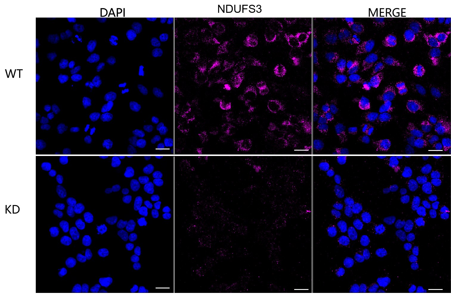NDUFS3 Antibody (23GB2145)