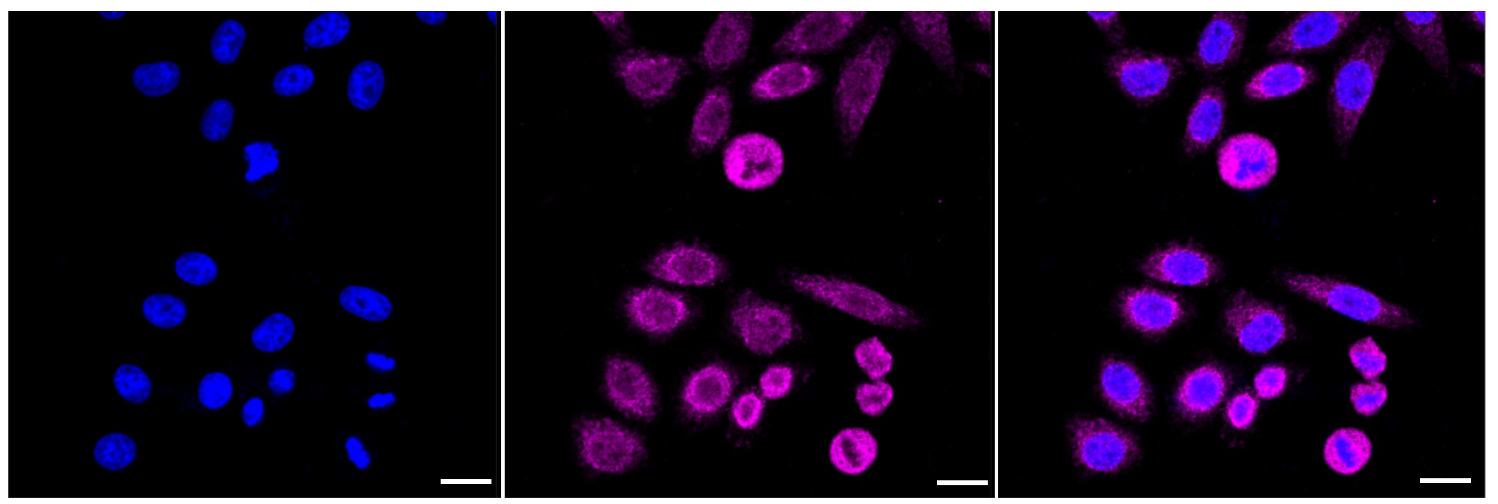 NDUFS3 Antibody (23GB2145)