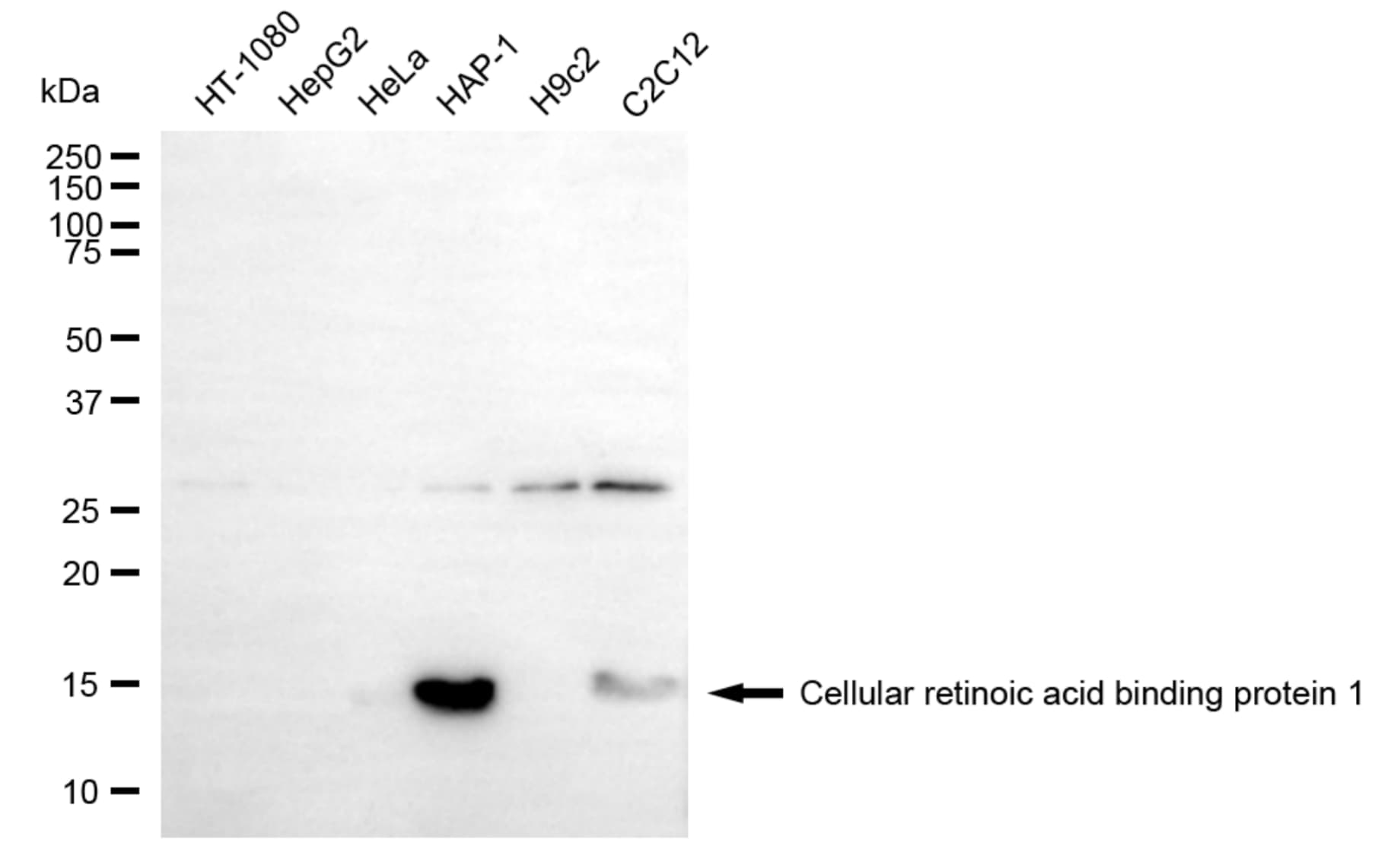 CRABP1 Antibody (24GB6125)