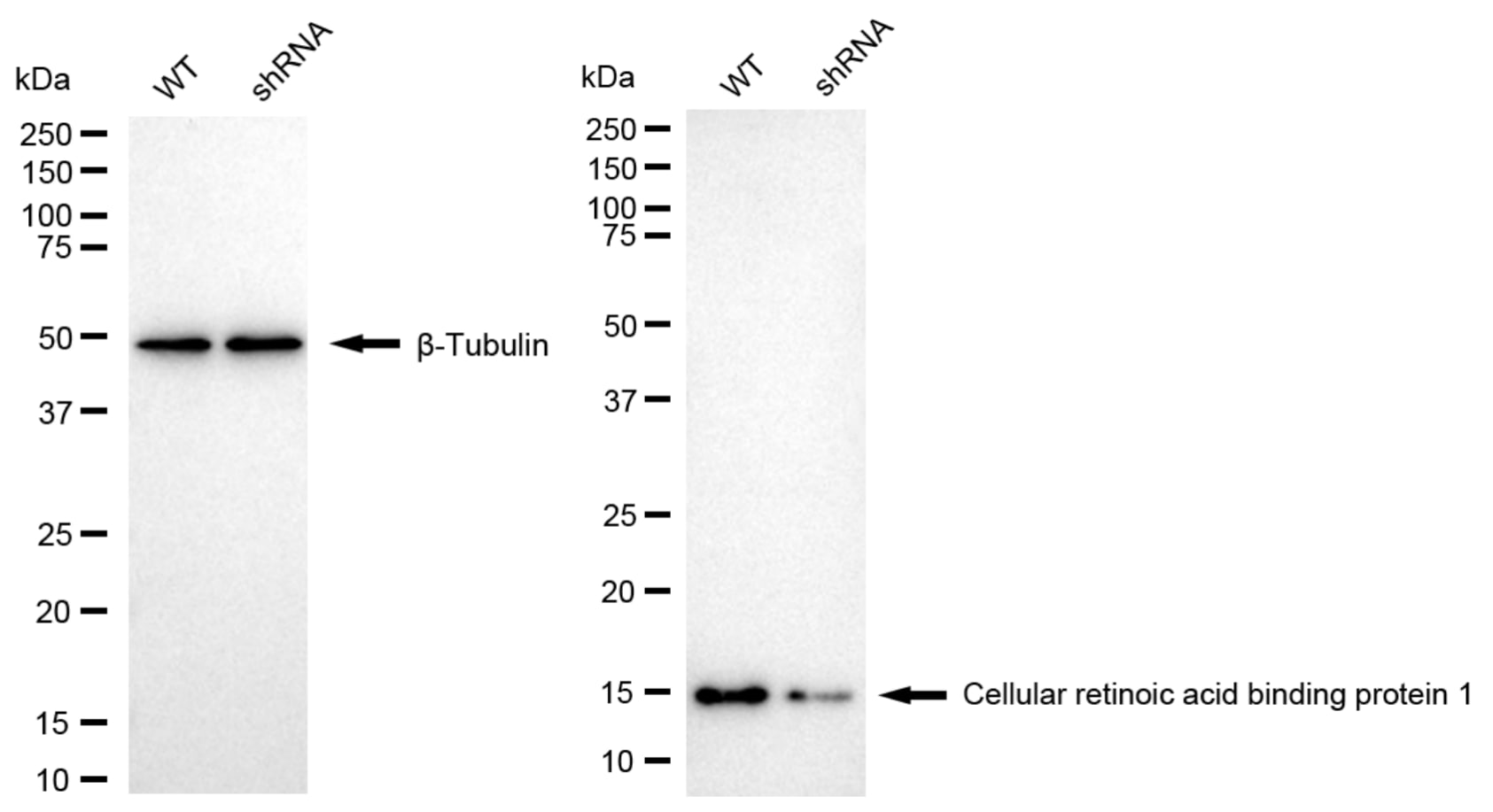 CRABP1 Antibody (24GB6125)