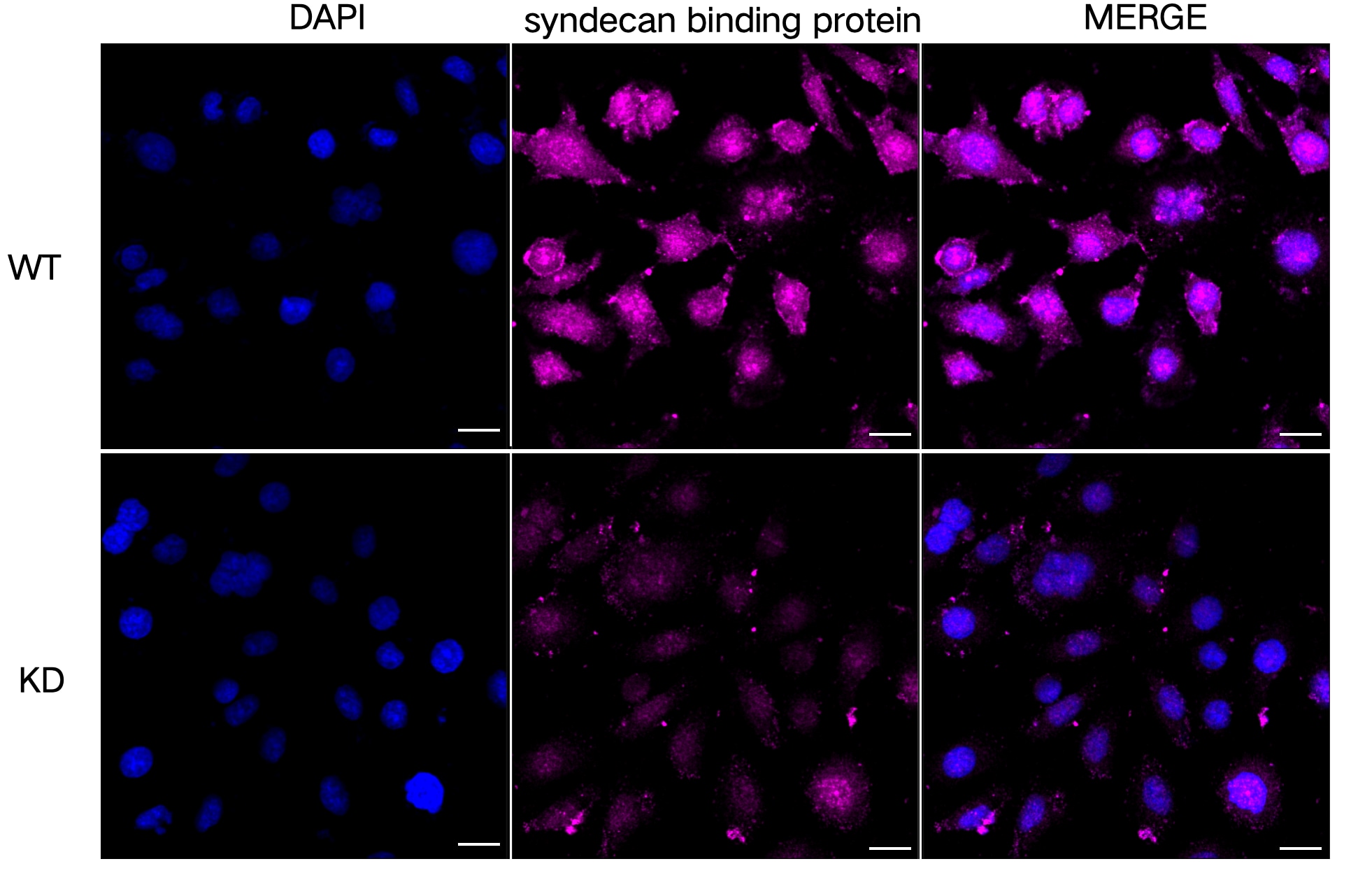 Syntenin 1 Antibody (23GB2185)