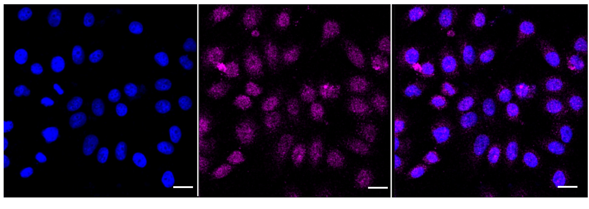 HPRT Antibody (24GB6185)