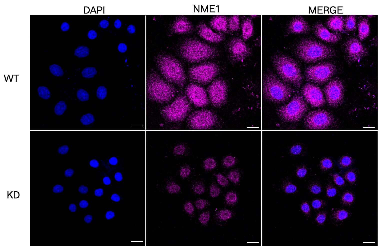 NM23-H1 Antibody (23GB2195)