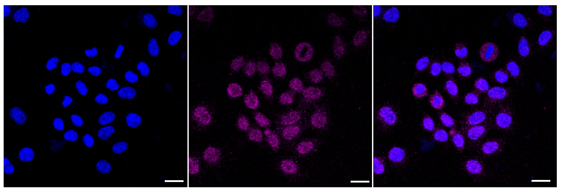 NM23-H1 Antibody (23GB2195)