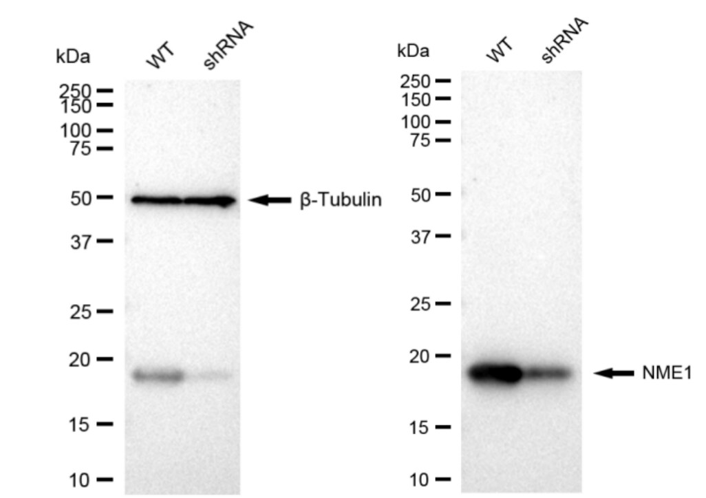 NM23-H1 Antibody (23GB2195)