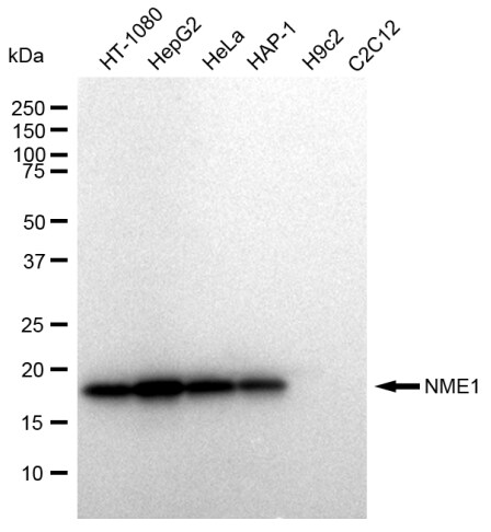 NM23-H1 Antibody (23GB2195)