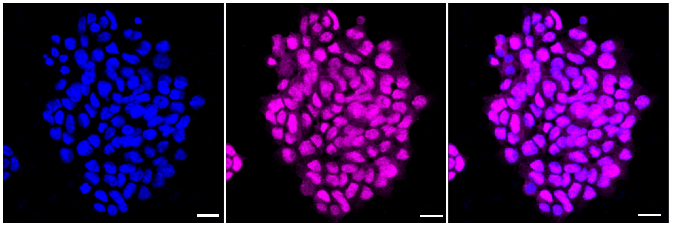 O-GlcNAcase/OGA/MGEA5 Antibody (24GB6120)