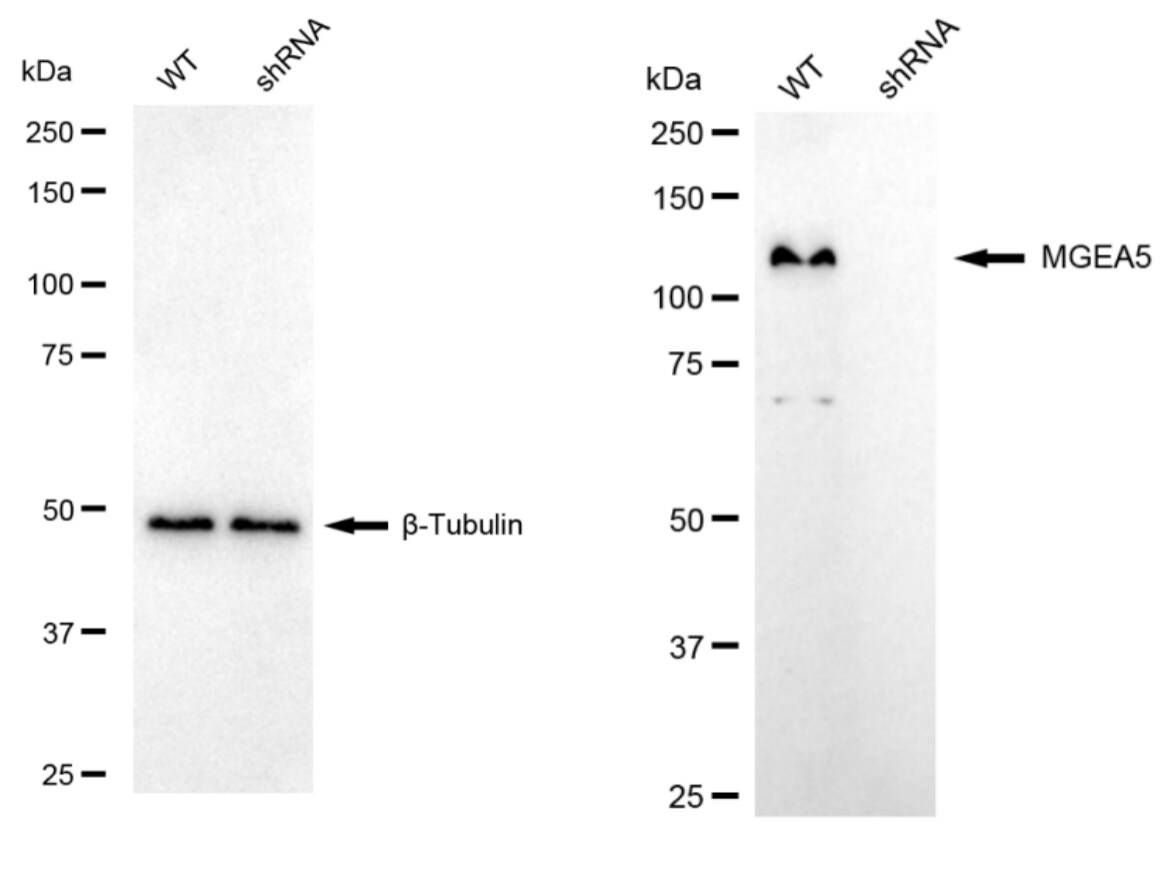 O-GlcNAcase/OGA/MGEA5 Antibody (24GB6120)