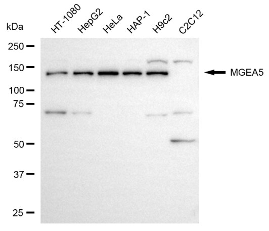 O-GlcNAcase/OGA/MGEA5 Antibody (24GB6120)