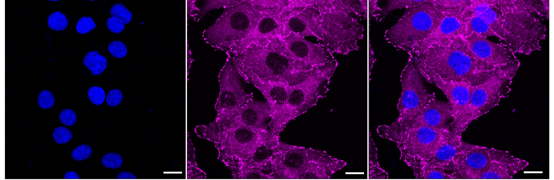 Vinculin Antibody (23GB2205)