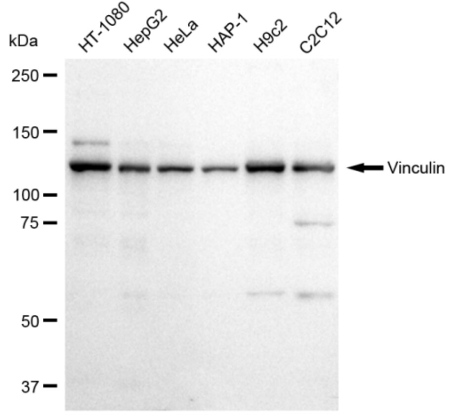 Vinculin Antibody (23GB2205)