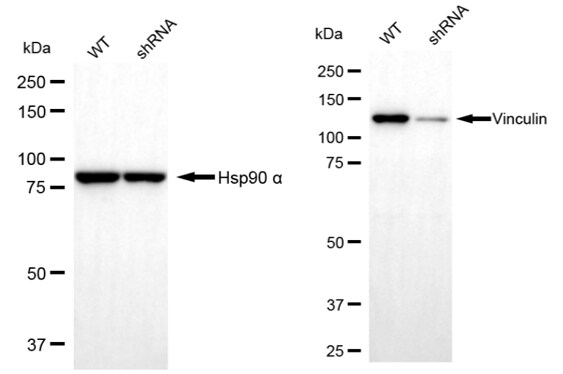 Vinculin Antibody (23GB2205)