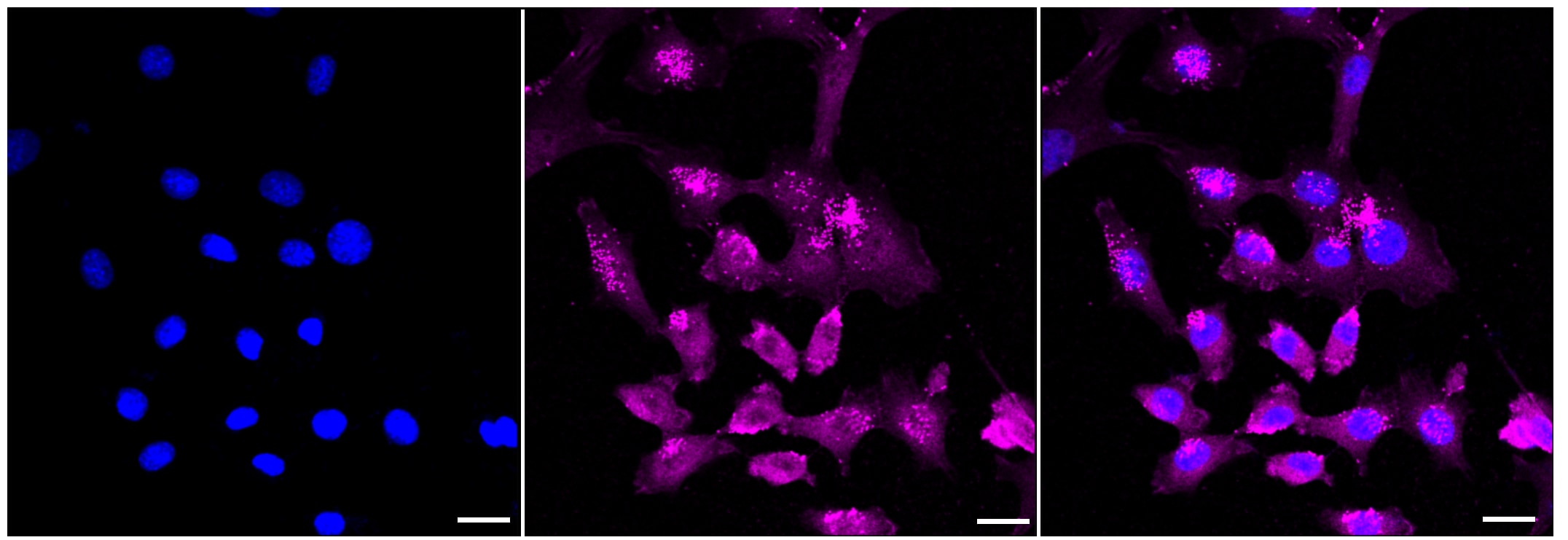 CHIP/STUB1 Antibody (23GB2345)