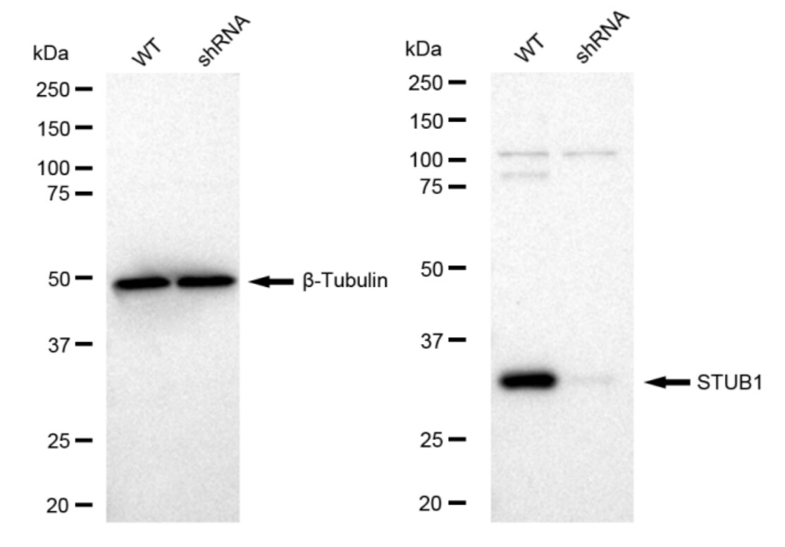 CHIP/STUB1 Antibody (23GB2345)
