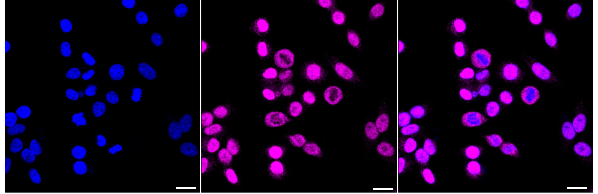 RACK1/GNB2L1 Antibody (23GB2355)
