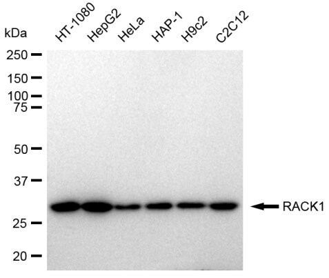 RACK1/GNB2L1 Antibody (23GB2355)