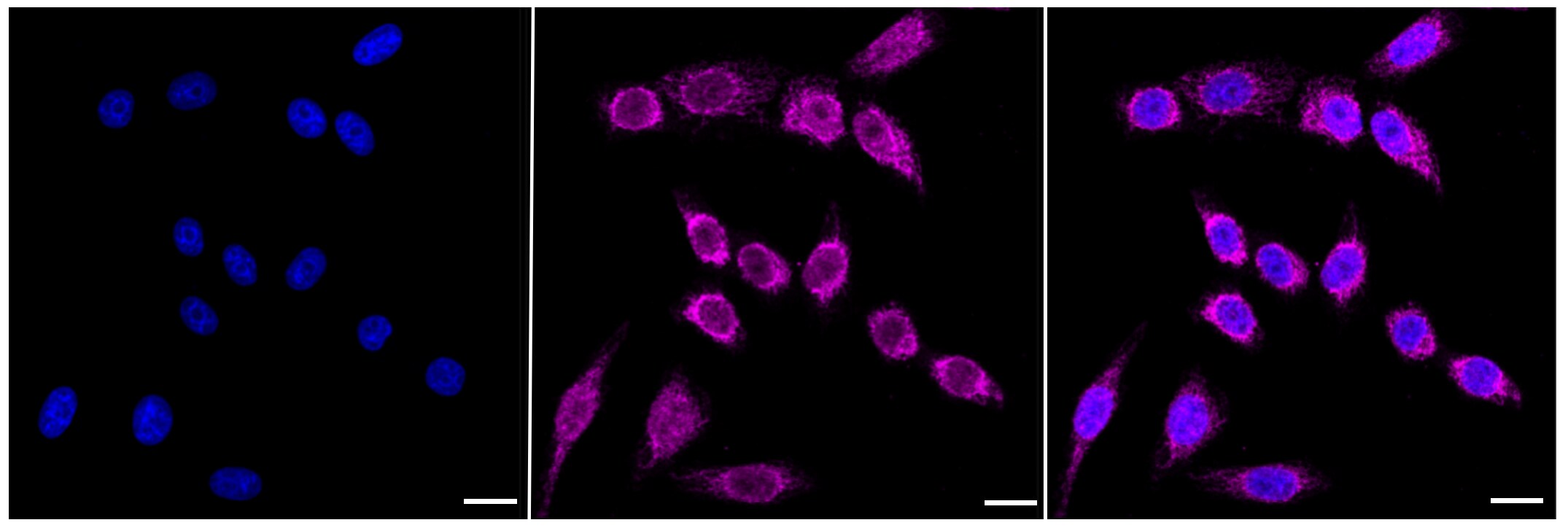 CPS1 Antibody (23GB2365)