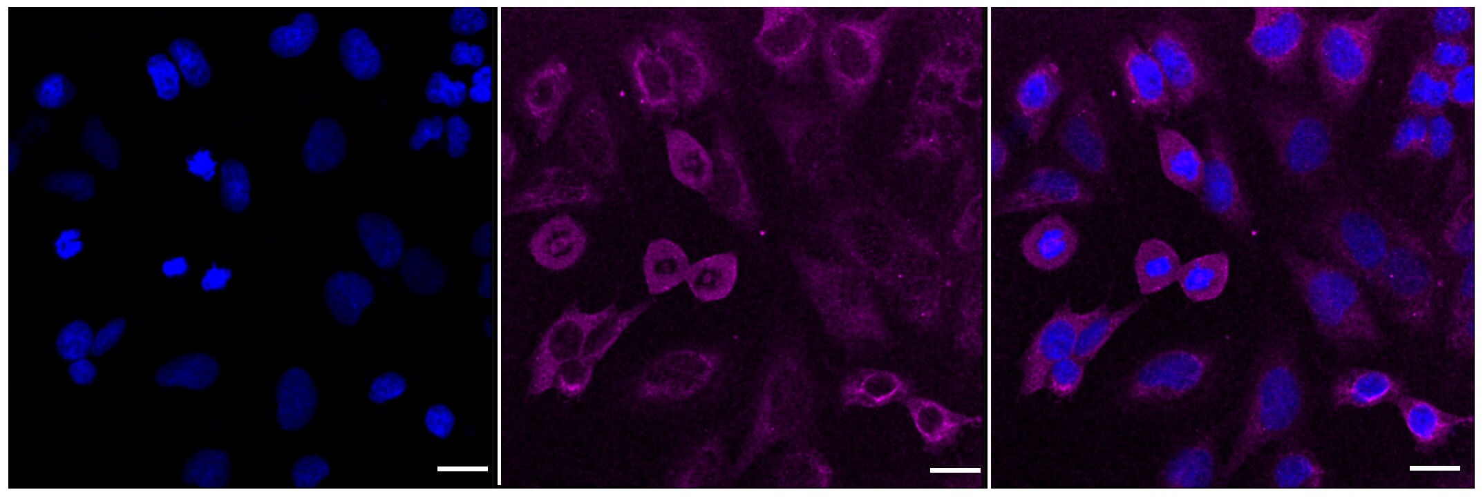 Calcineurin A Antibody (23GB2855)
