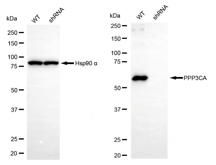 Calcineurin A Antibody (23GB2855)