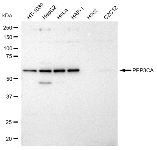 Calcineurin A Antibody (23GB2855)