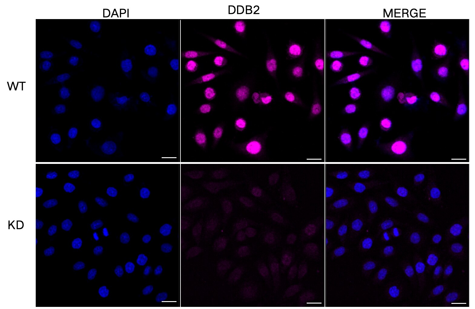 XPE/DDB2 Antibody (23GB2805)