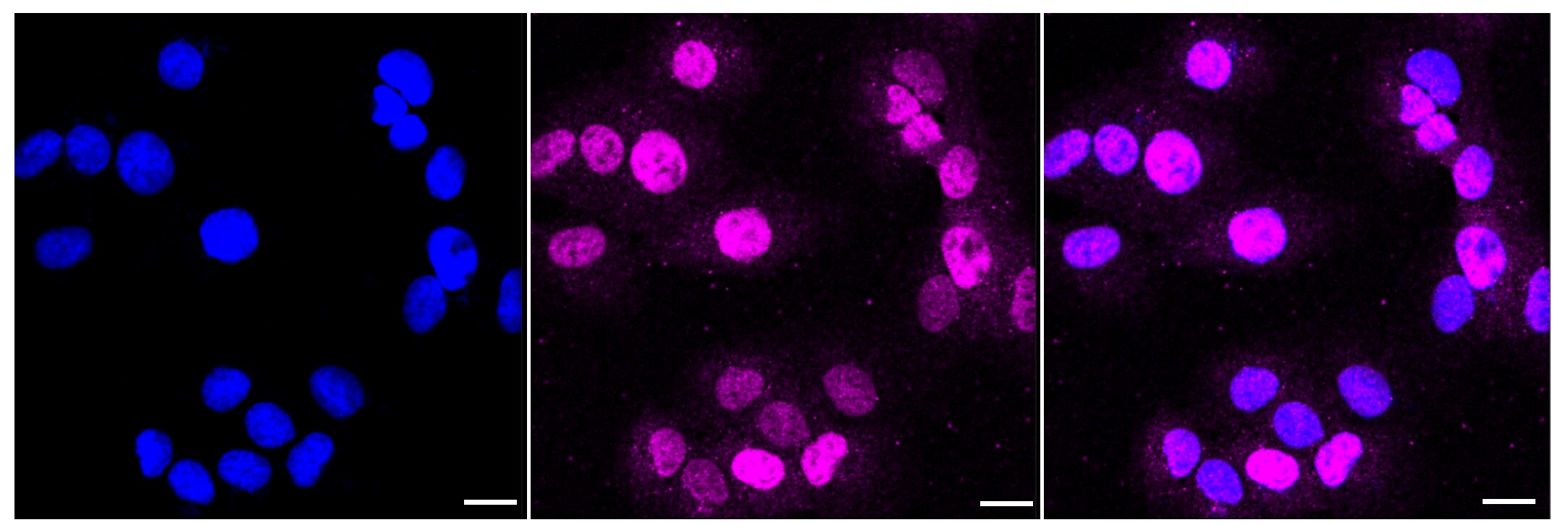 XPE/DDB2 Antibody (23GB2805)