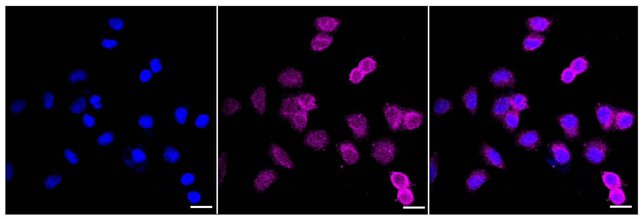 MEK1 Antibody (23GB2940)