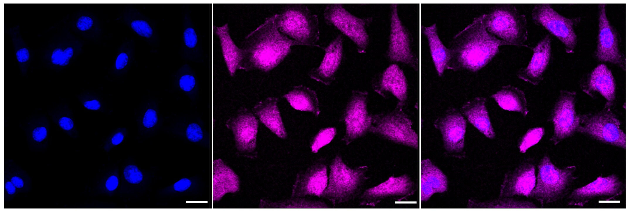 MKK3/MEK3 Antibody (23GB2420)