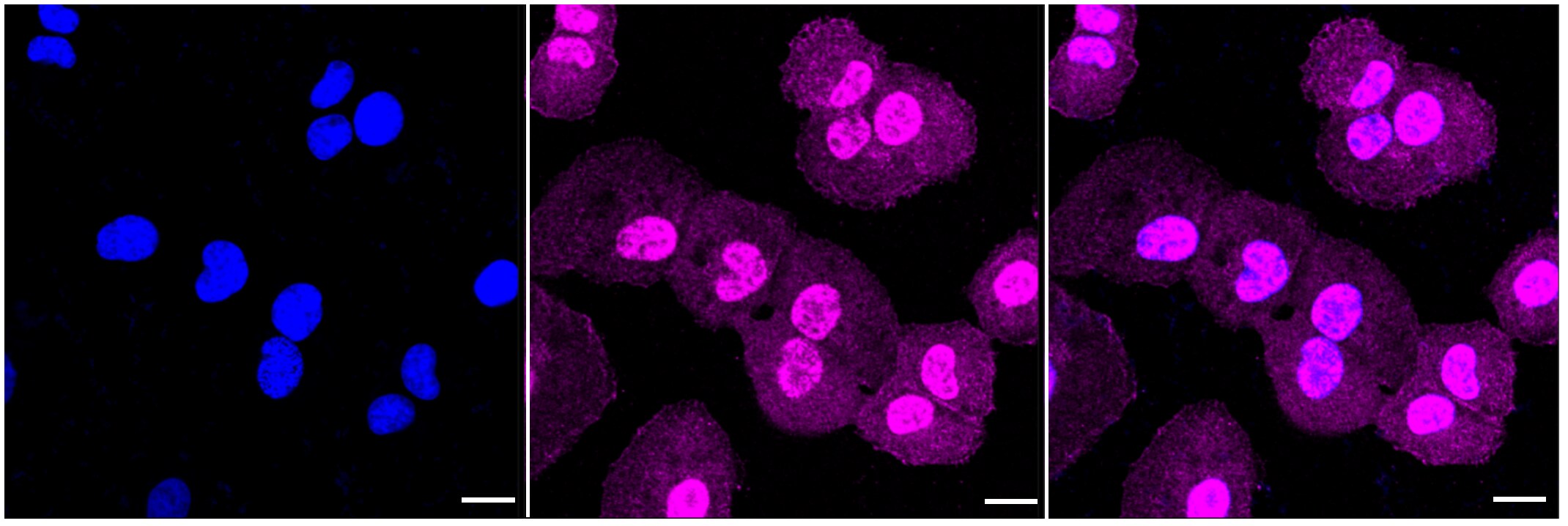 PAK2 Antibody (23GB2595)