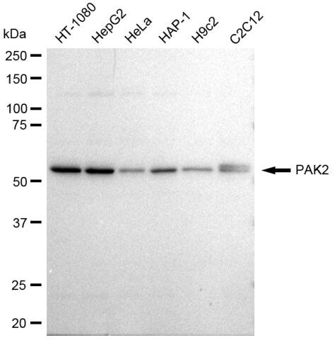 PAK2 Antibody (23GB2595)