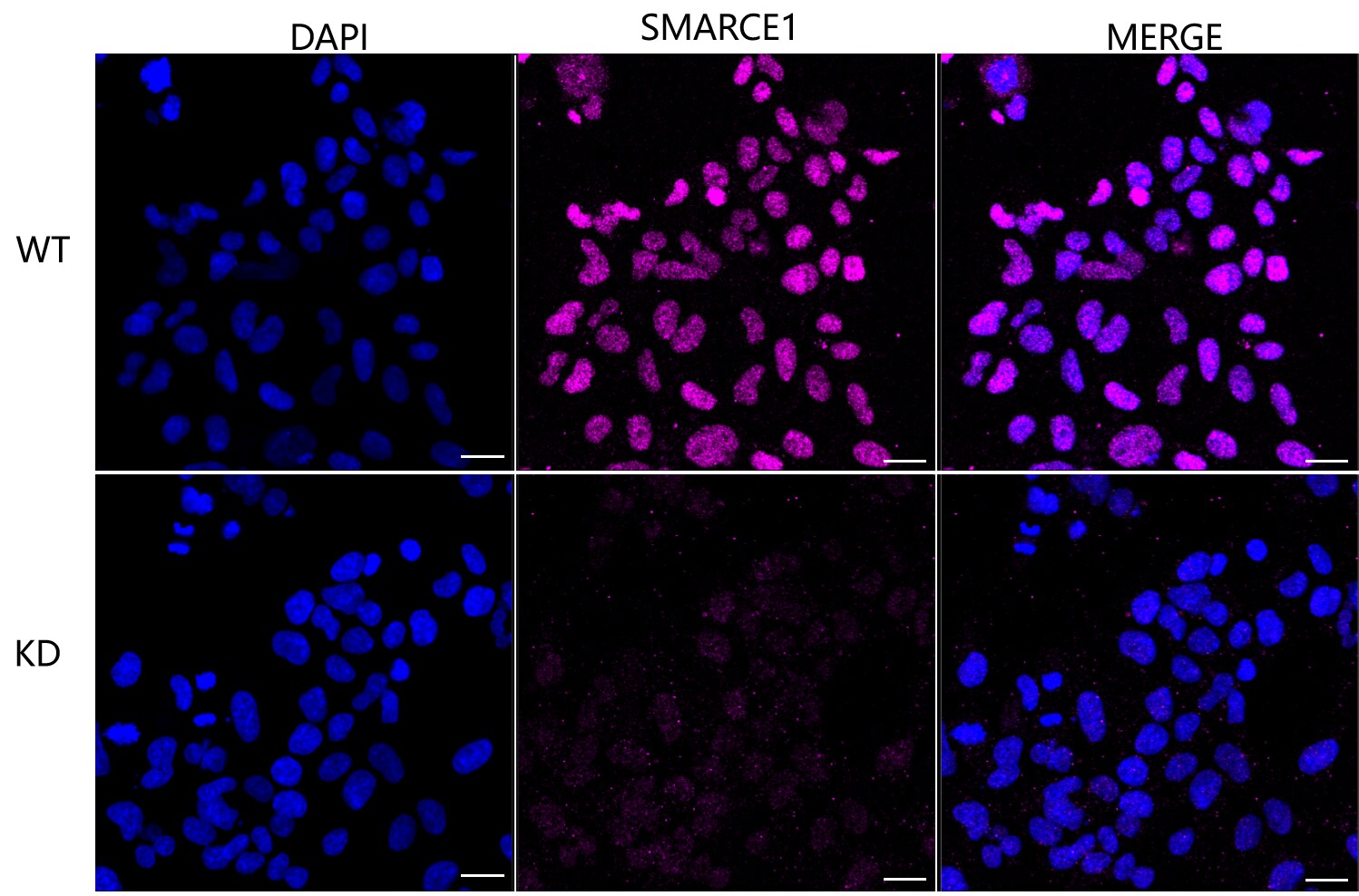 BAF57 Antibody (23GB2810)