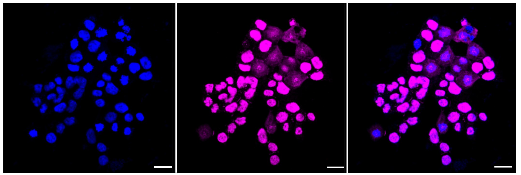 BAF57 Antibody (23GB2810)
