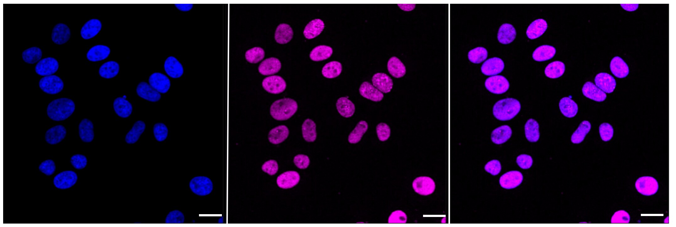 CHAF1A Antibody (23GB1060)