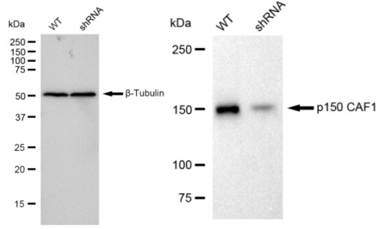 CHAF1A Antibody (23GB1060)