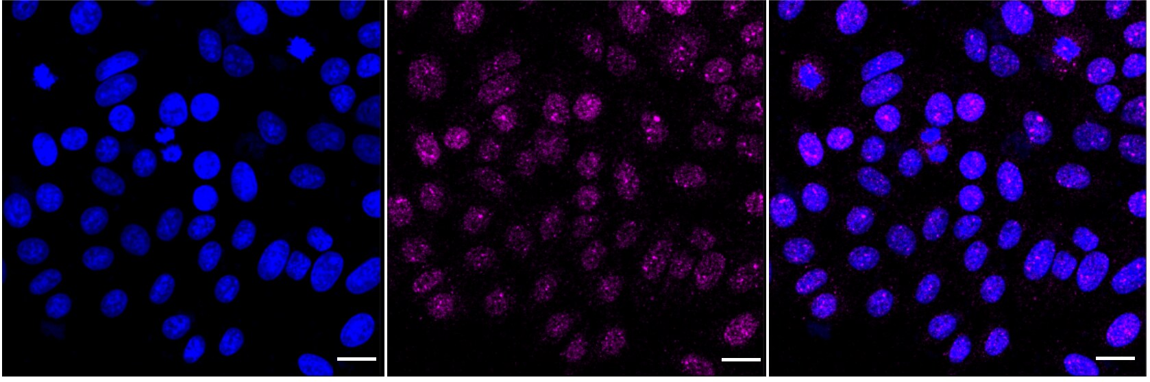 Catalase Antibody (23GB2625)