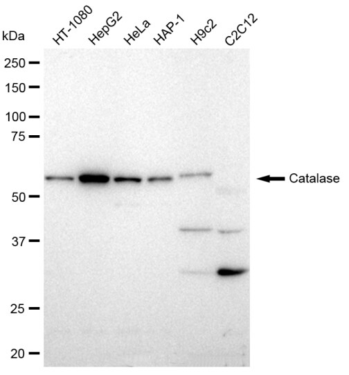 Catalase Antibody (23GB2625)