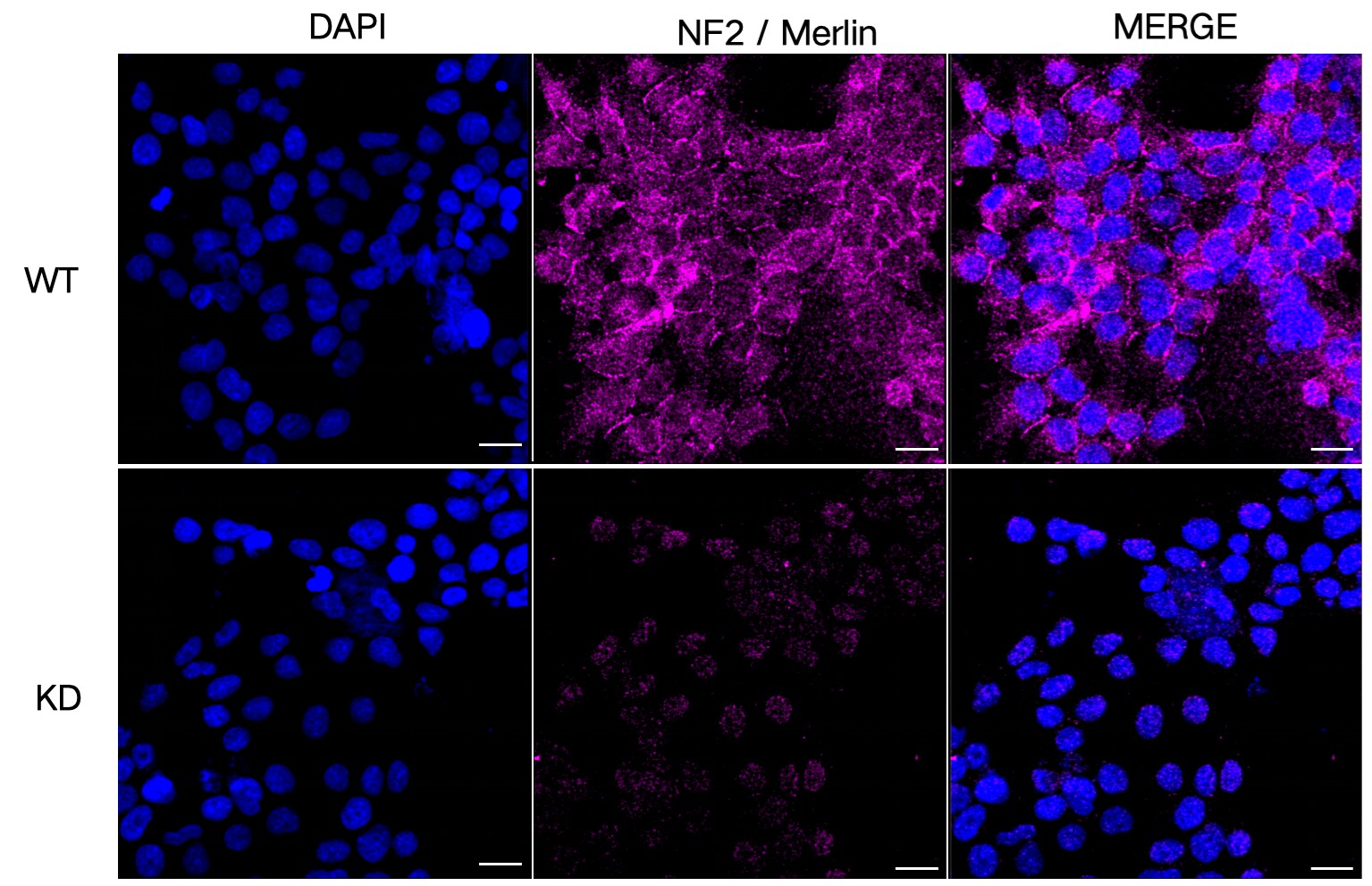 NF2/Merlin Antibody (23GB2620)