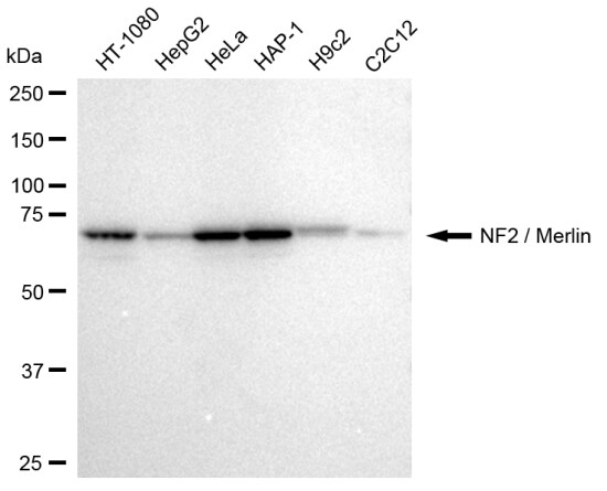 NF2/Merlin Antibody (23GB2620)