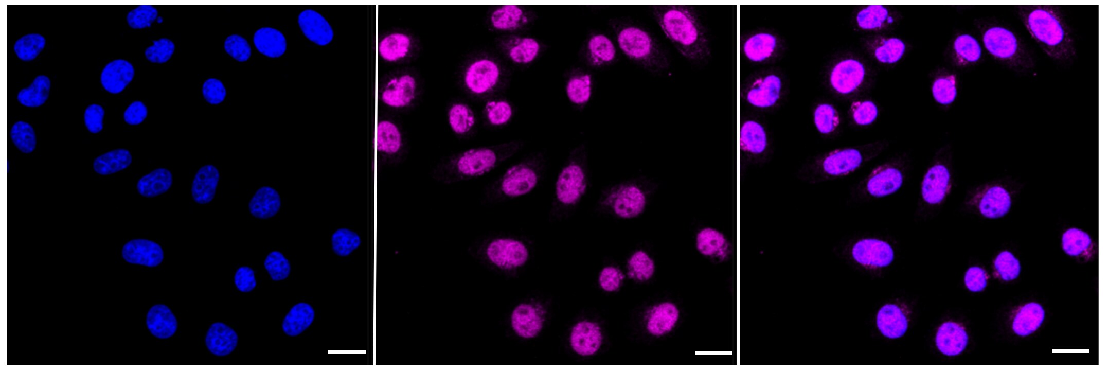 CHD4 Antibody (23GB1310)