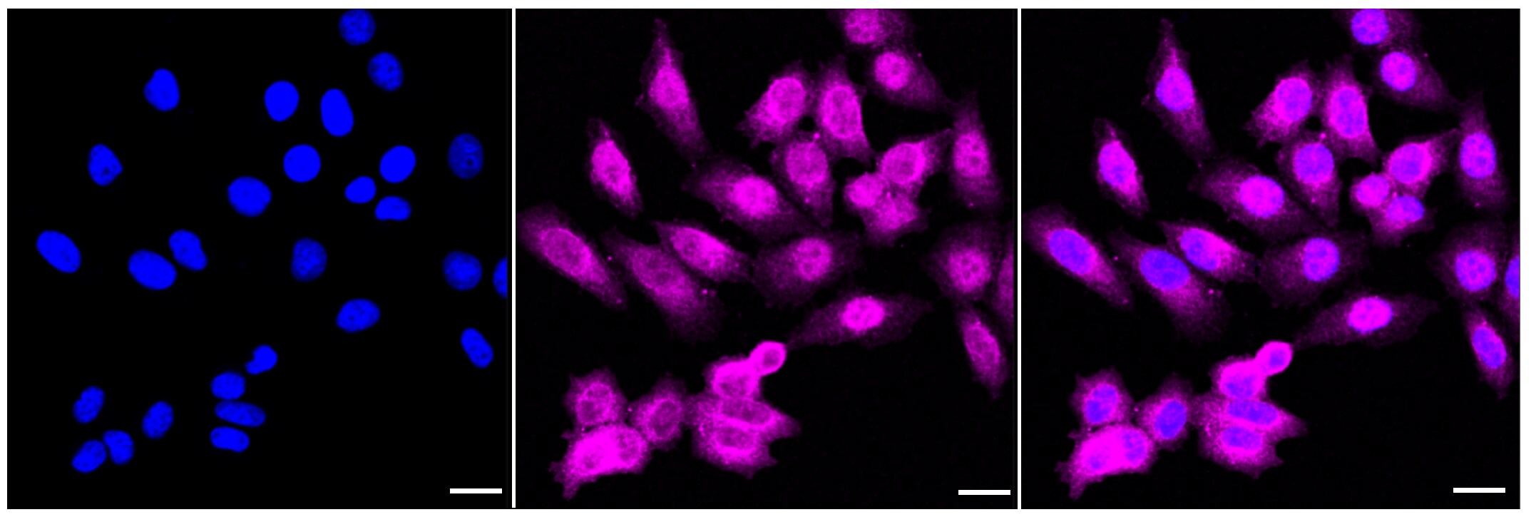 CHMP2B Antibody (23GB3070)