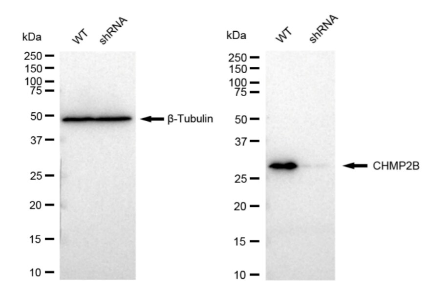 CHMP2B Antibody (23GB3070)