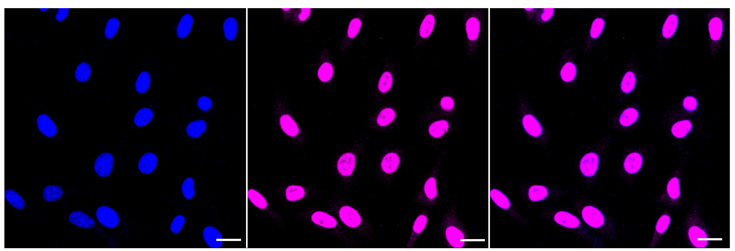 CIRBP Antibody (23GB7980)