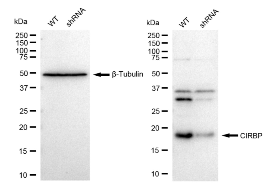 CIRBP Antibody (23GB7980)