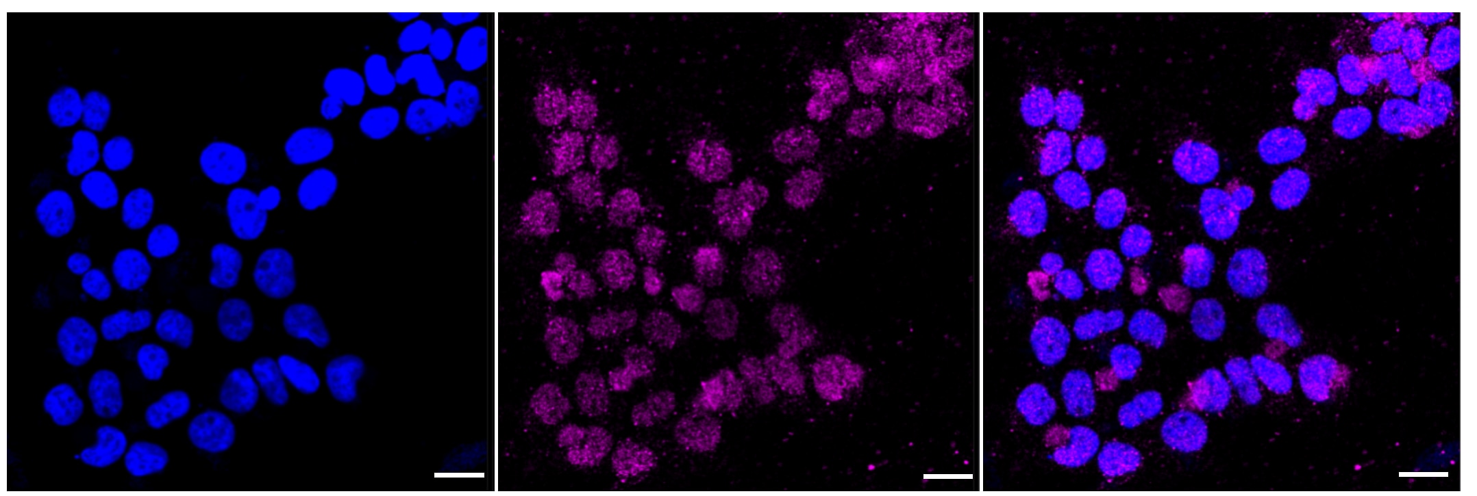 CD58/LFA-3 Antibody (23GB3050)