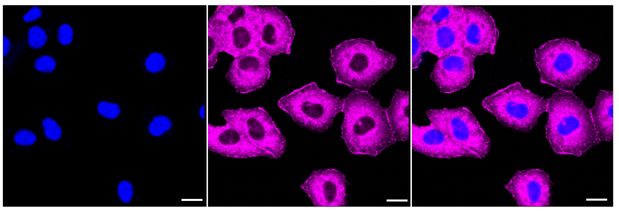 CAP1 Antibody (23GB3020)