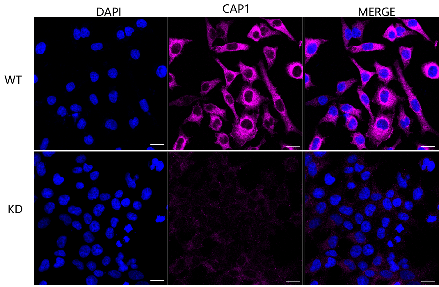 CAP1 Antibody (23GB3020)