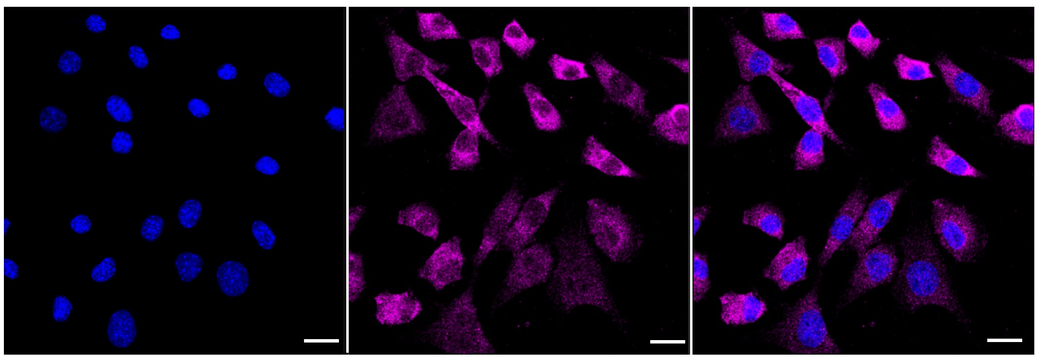 Bag-1 Antibody (23GB2995)